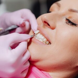 Dental Veneers - South Boston Dental Care Dental Veneers - South Boston Dental Care