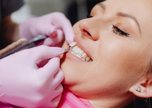 Dental Veneers - South Boston Dental Care Dental Veneers - South Boston Dental Care