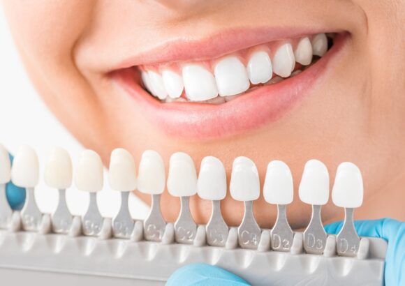 One Day Dental Crowns - South Boston Dental Care One Day Dental Crowns - South Boston Dental Care