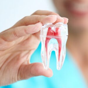 Root Canal Treatment - South Boston Dental Care Root Canal Treatment - South Boston Dental Care