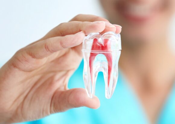 Root Canal Treatment - South Boston Dental Care Root Canal Treatment - South Boston Dental Care
