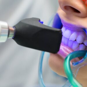 Teeth Whitening - South Boston Dental Care Teeth Whitening - South Boston Dental Care